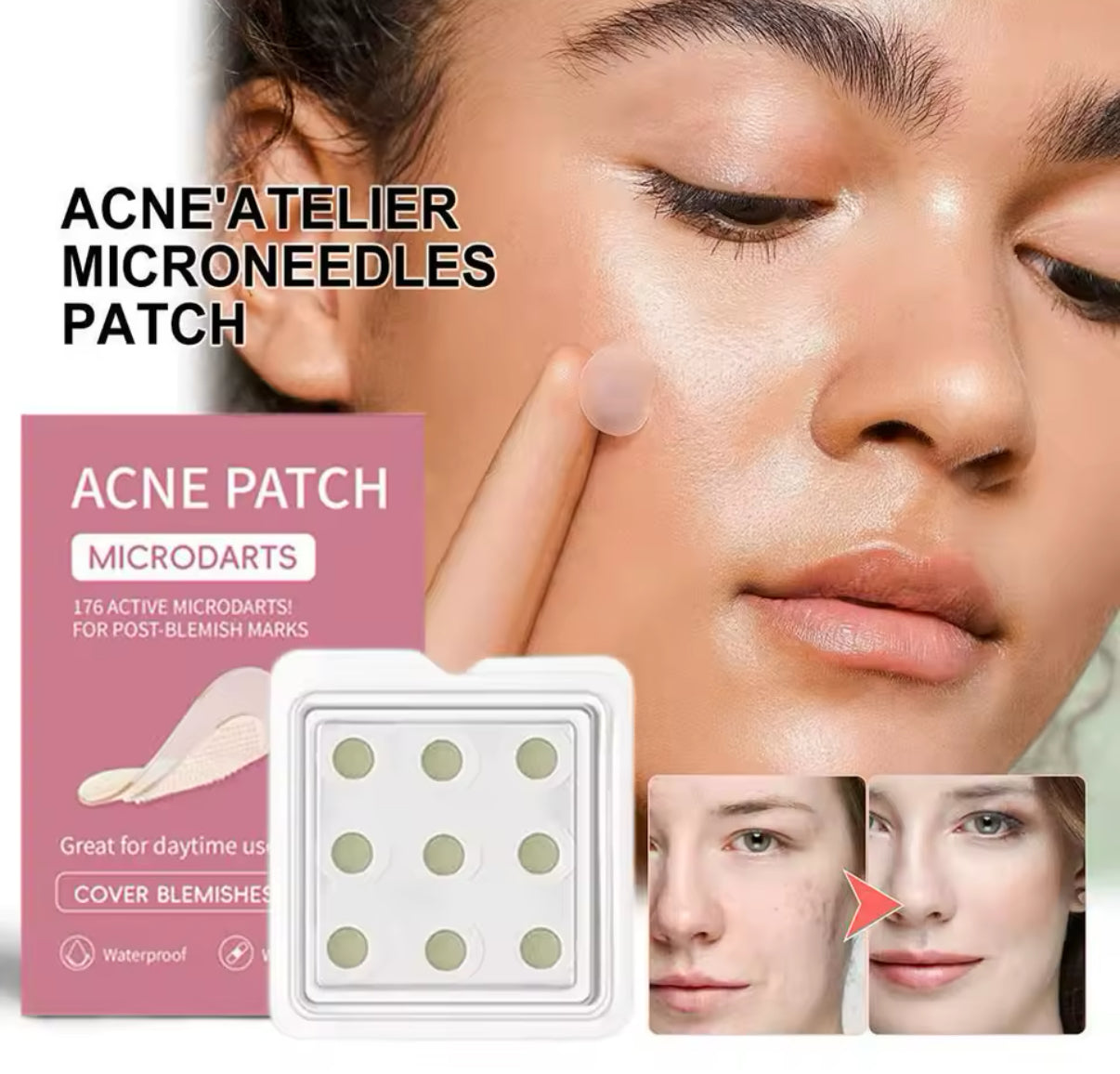 Skincare - Microneedling Acne Patches